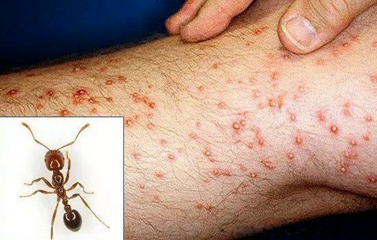 圖片4.png 圖片4.png