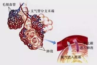 用ct来看看吸烟所导致的肺"众生相"