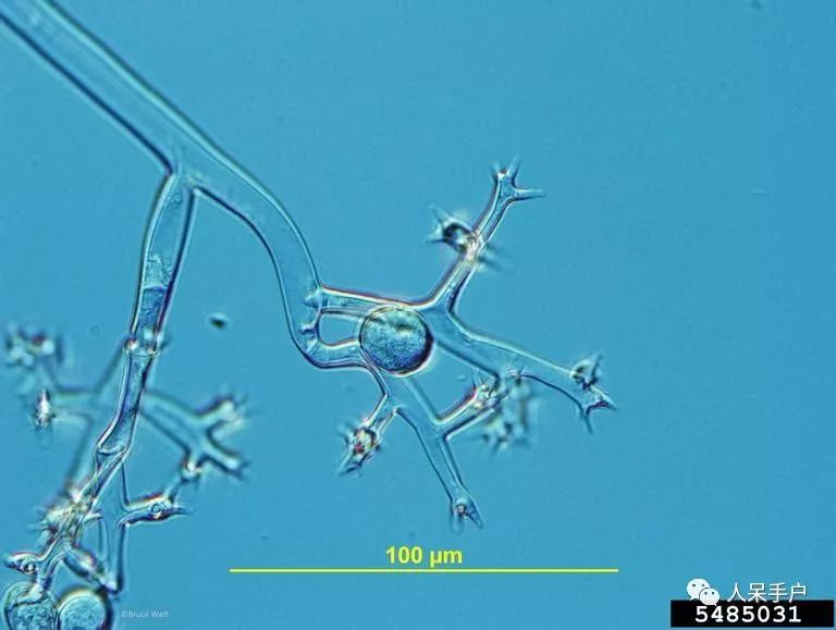 腐霉菌孢子囊梗图片