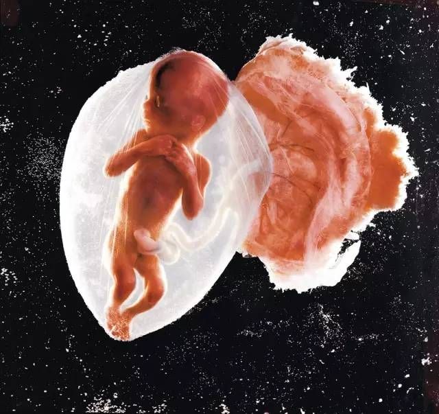 70天的胎儿图片图片